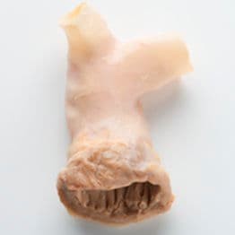 image of product آلوگرفت دریچه قلب