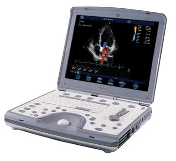 image of product دستگاه سونوگرافی در گروه تخصصی تصویربرداری مدل Rad20 با نام تجاری RADSON