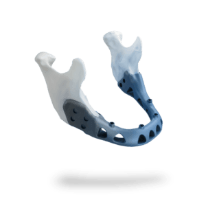 image of product طراحی و ساخت پروتز های شخصی سازه شده پزشکی